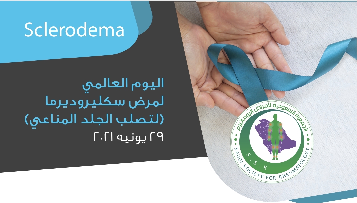 تصلب الجلد                                                                                                                                                                                                    Scleroderma